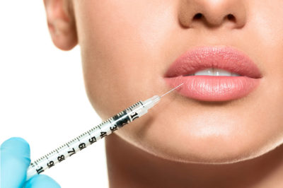 filler acido ialuronico