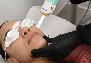una donna con gli occhialetti mentre si sottopone al trattamento con laser aerolase